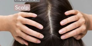 scalp irritation home remedies